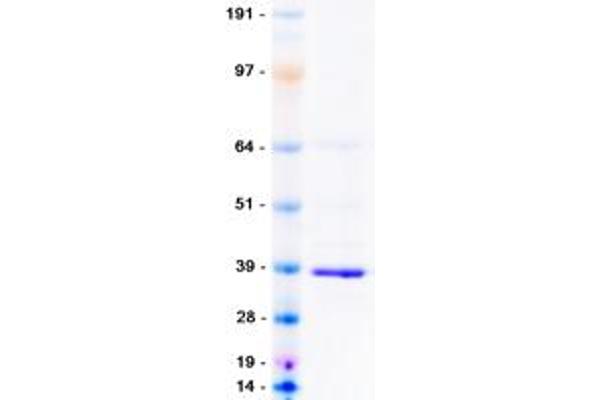 MCU Protein (Myc-DYKDDDDK Tag)