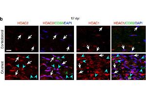 Immunofluorescence (Paraffin-embedded Sections) (IF (p)) image for anti-Histone Deacetylase 1 (HDAC1) antibody (ABIN2854776)