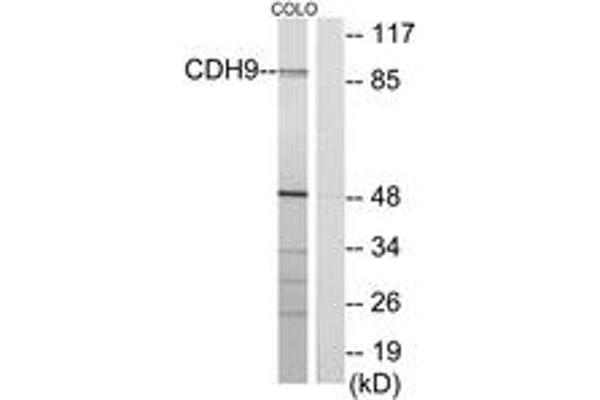 Cadherin 9 anticorps  (AA 201-250)