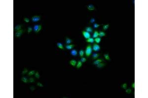 Immunofluorescence staining of PC-3 cells with ABIN7165742 at 1:16, counter-stained with DAPI. (LIX1 anticorps  (AA 1-282))