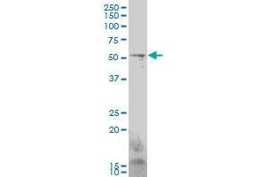 GCM1 monoclonal antibody (M06), clone 3D3. (GCM1 anticorps  (AA 108-166))