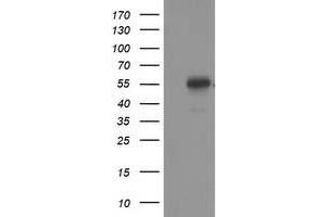 Western Blotting (WB) image for anti-Tumor Protein P53 (TP53) antibody (ABIN1499975) (p53 anticorps)