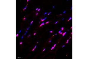 Immunofluorescence of paraffin embedded mouse Skeletal muscle using FUS (ABIN7075919) at dilution of 1:1000 (400x lens) (TLS/FUS anticorps)