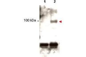 Western blot using  Protein A purified anti-Stat1 pY701 antibody shows detection of phosphorylated Stat1 (indicated by arrowhead at ~91 kDa) in K562 cells after 30 min treatment with 1Ku of hIFN-? (STAT1 anticorps  (pTyr701))