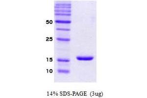 Figure annotation denotes ug of protein loaded and % gel used. (SNCA Protéine)