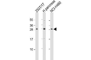 Western Blot at 1:1000 dilution Lane 1: 293T/17 whole cell lysate Lane 2: human pancreas lysate Lane 3: NCI-H460 whole cell lysate Lysates/proteins at 20 ug per lane. (COMTD1 anticorps  (C-Term))