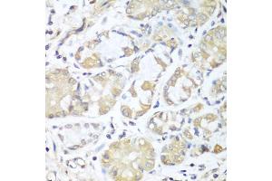 Immunohistochemistry of paraffin-embedded human stomach using RPH3AL antibody (ABIN5974449) at dilution of 1/100 (40x lens). (RPH3AL anticorps)