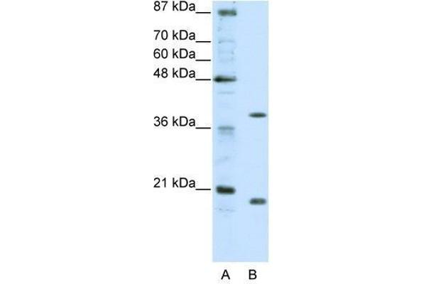 ZNF322A anticorps  (C-Term)