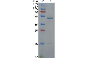 Human IL17C Protein, hFc Tag on SDS-PAGE under reducing condition. (IL17C Protein (AA 19-197) (Fc Tag))