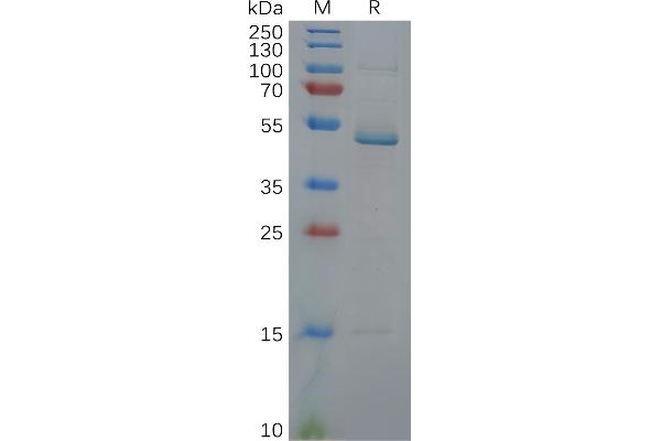 IL17C Protein (AA 19-197) (Fc Tag)