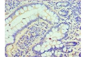 Immunohistochemistry of paraffin-embedded human small intestine tissue using ABIN7147585 at dilution of 1:100 (CLIC1 anticorps  (AA 42-241))