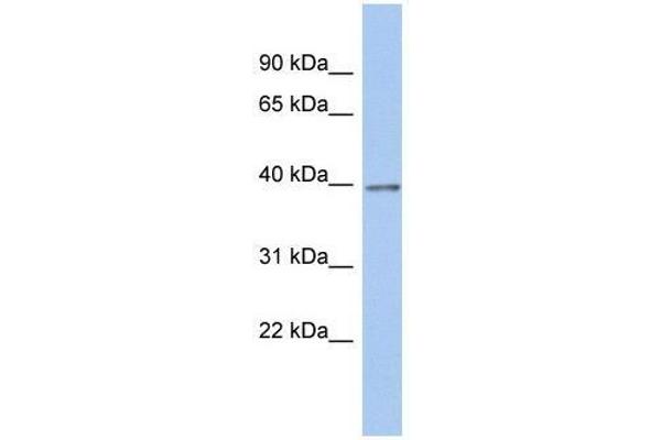 ZNF670 anticorps  (N-Term)