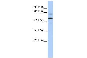 ARSA antibody used at 1 ug/ml to detect target protein. (Arylsulfatase A anticorps  (Middle Region))