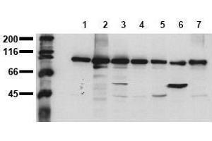 Western Blotting (WB) image for anti-Catenin (Cadherin-Associated Protein), beta 1, 88kDa (CTNNB1) (C-Term) antibody (ABIN126749) (CTNNB1 anticorps  (C-Term))