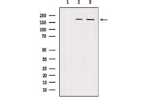 Western blot analysis of extracts from various samples, using VPRBP Antibody. (VPRBP anticorps)