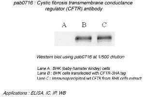 Image no. 2 for anti-Cystic Fibrosis Transmembrane Conductance Regulator (ATP-Binding Cassette Sub-Family C, Member 7) (CFTR) (N-Term) antibody (ABIN559719) (CFTR anticorps  (N-Term))