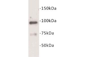 Western Blotting (WB) image for anti-Junctophilin 2 (JPH2) antibody (ABIN1854929) (Junctophilin 2 anticorps)