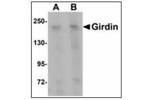 Western blot analysis of Girdin in rat brain tissue lysate with Girdin antibody at (A) 1 and (B) 2 µg/ml. (Girdin anticorps  (C-Term))