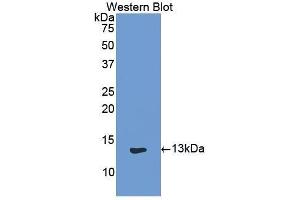 Western Blotting (WB) image for anti-Keratin 1 (KRT1) (AA 489-625) antibody (ABIN1859571) (Cytokeratin 1 anticorps  (AA 489-625))