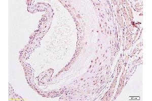 Immunohistochemistry (Paraffin-embedded Sections) (IHC (p)) image for anti-Nuclear Factor-kB p65 (NFkBP65) (AA 51-100) antibody (ABIN668961)