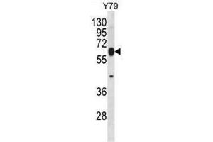 RNF180 Antibody (C-term) western blot analysis in Y79 cell line lysates (35µg/lane). (RNF180 anticorps  (C-Term))