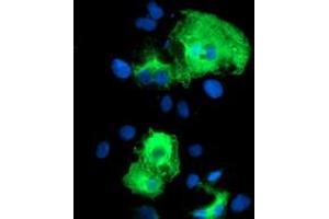 Anti-SCHIP1 mouse monoclonal antibody (ABIN2455645) immunofluorescent staining of COS7 cells transiently transfected by pCMV6-ENTRY SCHIP1 (RC206269). (SCHIP1 anticorps)