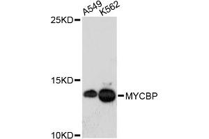 Western blot analysis of extracts of various cell lines, using MYCBP antibody. (MYCBP anticorps)