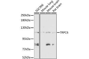Western blot analysis of extracts of various cell lines, using TRPC6 antibody (ABIN7270918) at 1:1000 dilution. (TRPC6 anticorps  (AA 732-931))