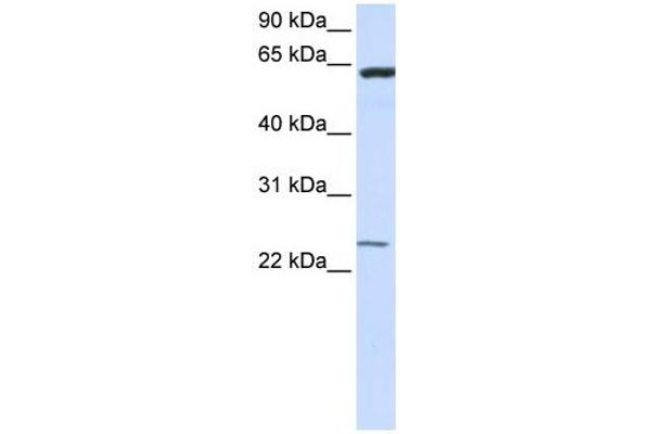 TMEM138 anticorps