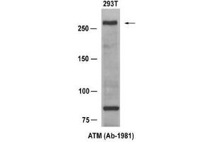 Western blot analysis of extract from 293T cells, using ATM (Ab-1981) Antibody (E021147). (ATM anticorps)