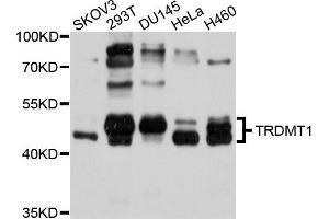 Western blot analysis of extracts of various cells, using TRDMT1 antibody. (Dnmt2 anticorps)