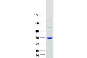 Validation with Western Blot (ROGDI Protein (Myc-DYKDDDDK Tag))