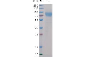 Human 2B4, mFc-His Tag on SDS-PAGE under reducing condition. (2B4 Protein (AA 22-221) (mFc-His Tag))