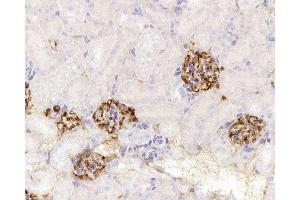 Immunohistochemistry analysis of paraffin-embedded mouse kidney using NES Monoclonal Antibody at dilution of 1:400. (Nestin anticorps)