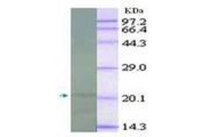 Image no. 2 for anti-Interleukin 18 (IL18) antibody (ABIN791564) (IL-18 anticorps)