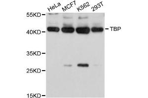 Western blot analysis of extracts of various cell lines, using TBP antibody (ABIN5971218) at 1/1000 dilution. (TBP anticorps)