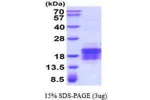 SDS-PAGE (SDS) image for Vascular Endothelial Growth Factor C (VEGFC) (AA 112-227) protein (His tag) (ABIN5854525) (VEGFC Protein (AA 112-227) (His tag))