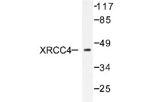 Image no. 1 for anti-X-Ray Repair Complementing Defective Repair in Chinese Hamster Cells 4 (XRCC4) antibody (ABIN271982) (XRCC4 anticorps)