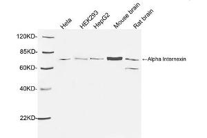 Western blot analysis of tissue and cell lysates using 1 µg/mL Rabbit Anti-Alpha Internexin Polyclonal Antibody (ABIN398867) The signal was developed with IRDyeTM 800 Conjugated Goat Anti-Rabbit IgG. (INA anticorps  (AA 100-150))