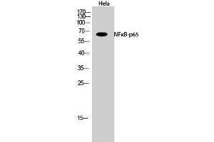 Western Blotting (WB) image for anti-Nuclear Factor-kB p65 (NFkBP65) (Thr735) antibody (ABIN3185891) (NF-kB p65 anticorps  (Thr735))
