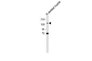 Anti-BCORL1 Antibody (N-term) at 1:500 dilution + Rat skeletal muscle lysate Lysates/proteins at 20 μg per lane. (BCORL1 anticorps  (N-Term))