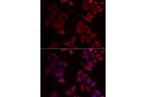 Immunofluorescence analysis of U2OS cells using NCR1 antibody. (NCR1 anticorps)