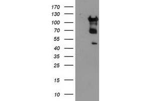 HEK293T cells were transfected with the pCMV6-ENTRY control (Left lane) or pCMV6-ENTRY MTFMT (Right lane) cDNA for 48 hrs and lysed. (MTFMT anticorps  (AA 175-389))