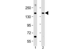 Western blot testing of human 1) brain and 2) lung lysate with MTUS1 antibody at 1:2000. (MTUS1 anticorps  (AA 183-226))