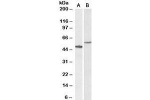 Western blot testing of human hippocampus [A] and HeLa [B] lysates with CD47 antibody at 0. (CD47 anticorps)