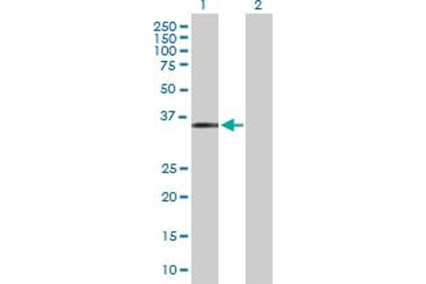 MAGEF1 anticorps  (AA 1-307)