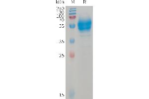 Human BTC Protein, hFc Tag on SDS-PAGE under reducing condition. (Betacellulin Protein (BTC) (AA 32-111) (Fc Tag))