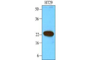 Western Blotting (WB) image for anti-Calcium and Integrin-Binding Protein 1 (CIB1) (AA 1-191) antibody (ABIN6245682) (CIB1 anticorps  (AA 1-191))