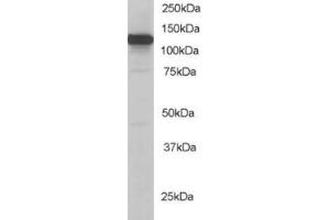 Western Blotting (WB) image for anti-Kinesin Family Member 5B (KIF5B) (C-Term) antibody (ABIN2465236) (KIF5B anticorps  (C-Term))