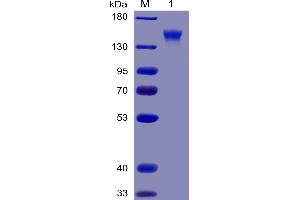 Human CD96 Protein, mFc-His Tag on SDS-PAGE under reducing condition. (CD96 Protein (CD96) (AA 22-503) (mFc-His Tag))